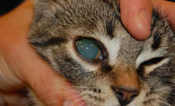 У больных катарактой зрачки расширяются и перестают реагировать на свет