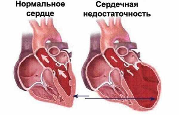 Здоровое сердце собаки и сердечная недостаточность Здоровое сердце собаки и сердечная недостаточность